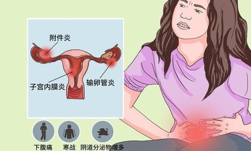 想知道自己有没有盆腔炎,除了上面说的症状外,还可以来医院主要做三个